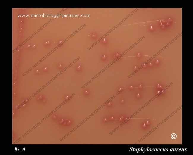 methicillin resistant Staphylococcus aureus (MRSA) colonies